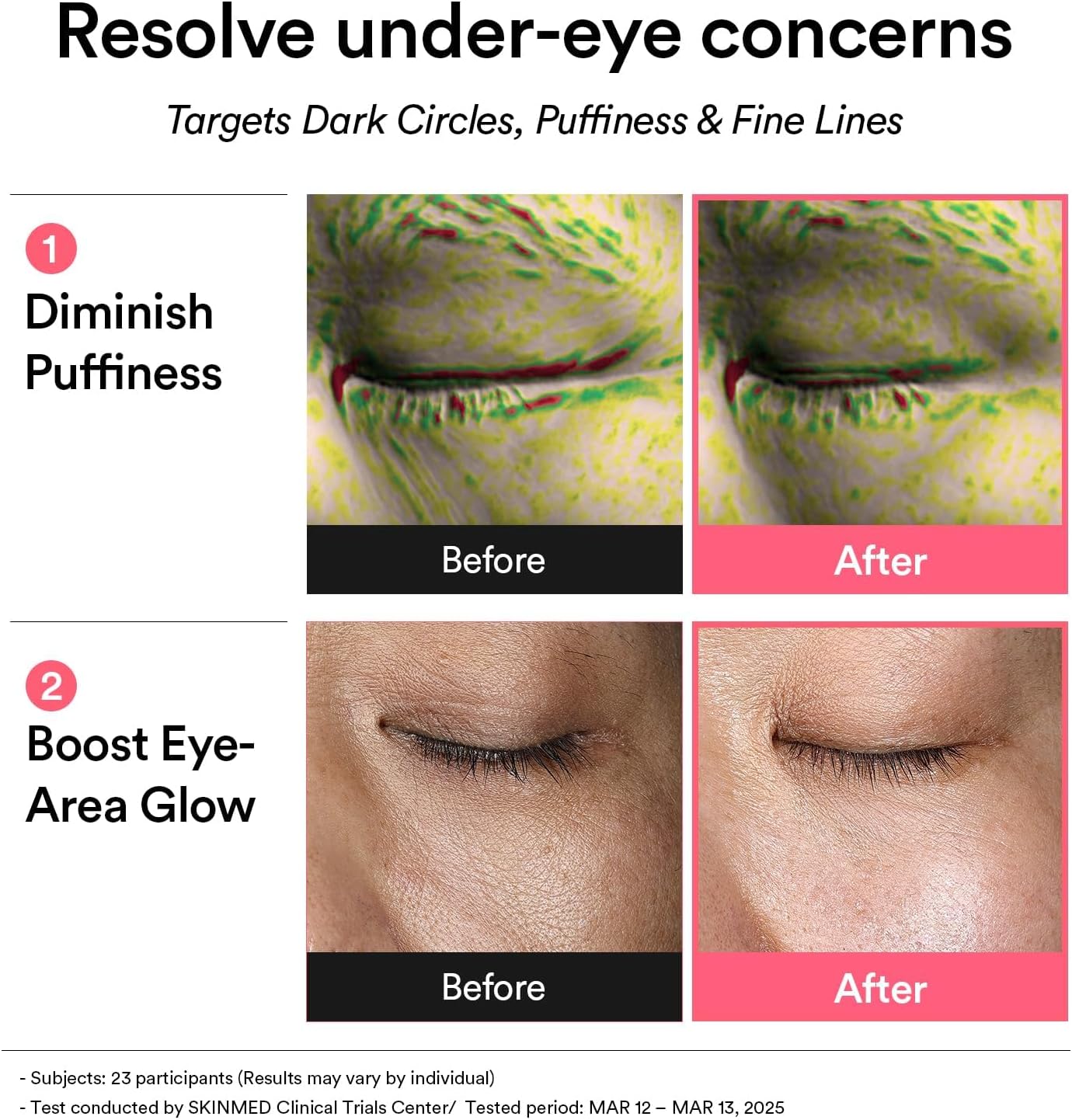 Abib PDRN Retinal Eye Patch 60s