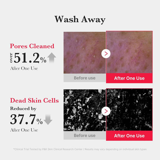 Medicube Red Foam Cleanser for Sensitiive and Acne-Prone Skin 120mL